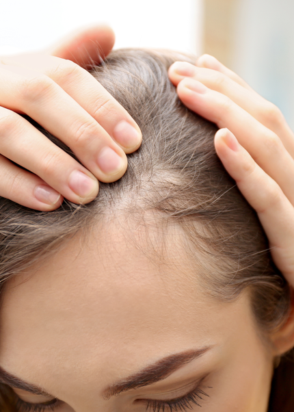 Tonico Cebolla y Cafe para la Caida y Crescimiento del Pelo